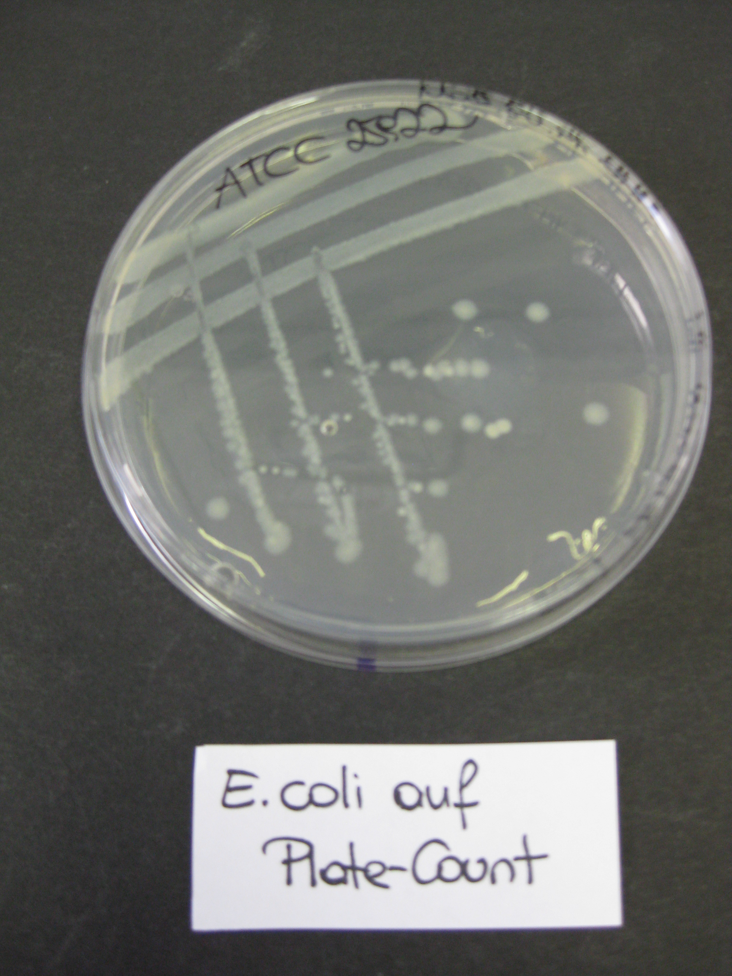 E.coli Kulturausstrich